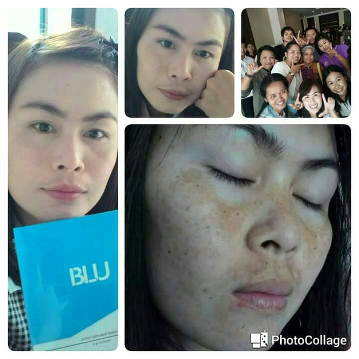 ออร่าหน้าใส