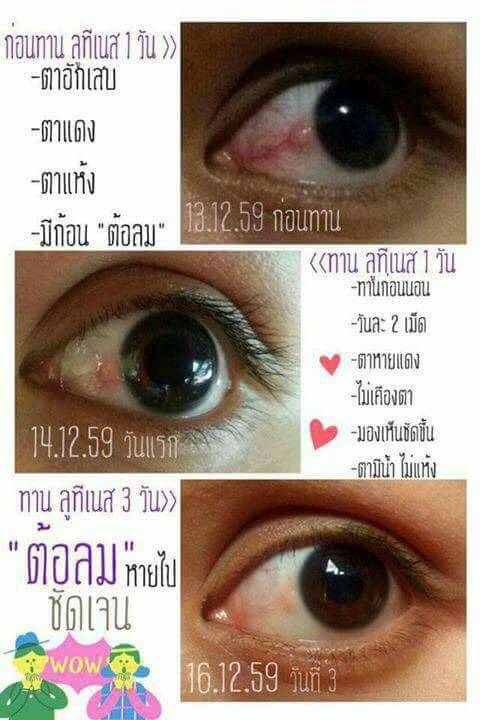 Luteines healthybuffets รีวิวจากผู้ใช้ลูทีเนสจริง