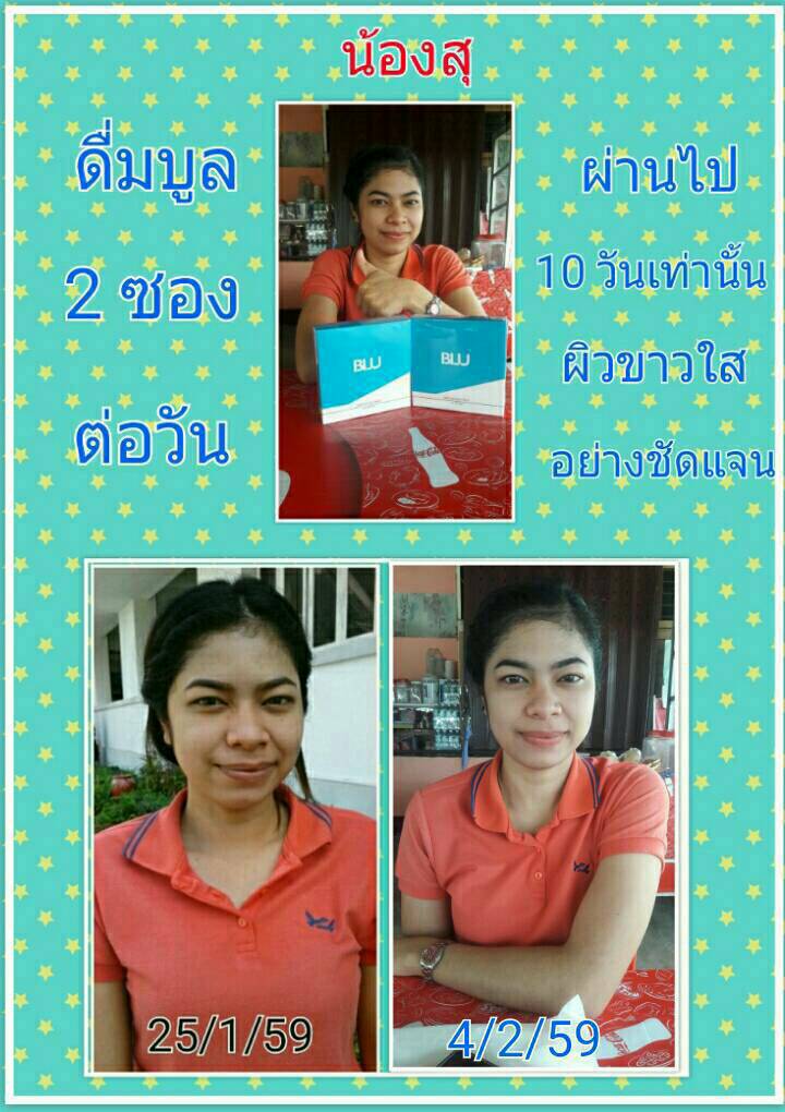 ออร่าหน้าใส ผิวดี ไม่มีดำ