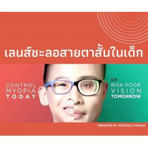 เลนส์ชะลอสายตาสั้นในเด็ก
