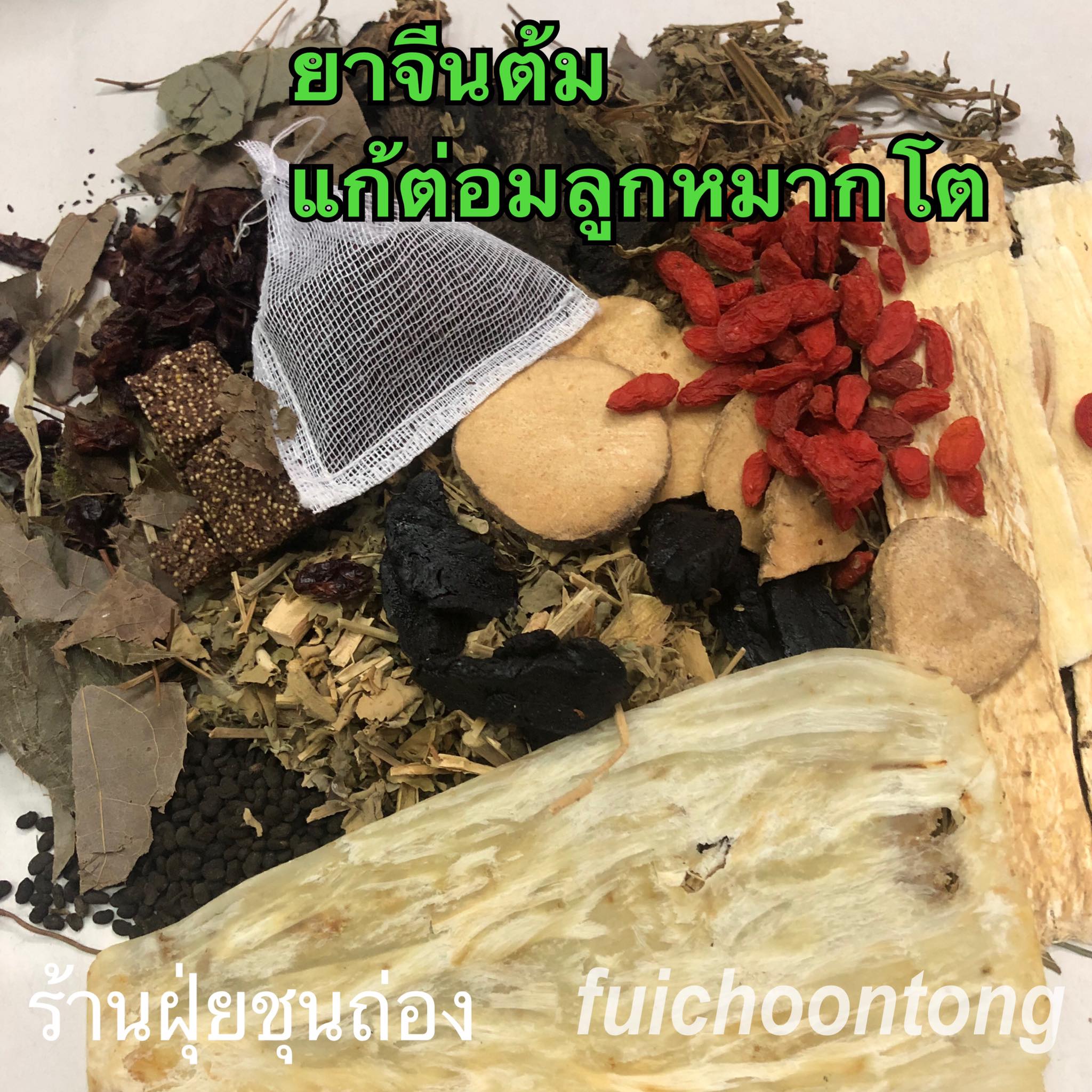 ต่อมลูกหมากโต