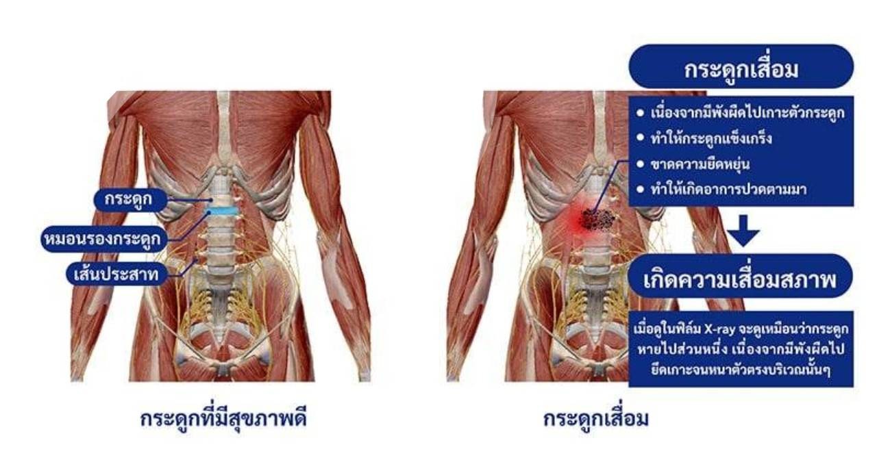 1 hrs Massage catching / นวดจับเส้น 👍นวดแก้อาการ 📌นวดจับเส้น 📌เอ็นเข้าสะบัก📌ไหล่ติด📌ปวดหลัง📌ชา📌ปวดขา📌ปวดสลักเพชร📌ท้องอืด📌ไมเกรน📌คอตกหมอน 📌หมอนรองกระดูกทับเส้นป