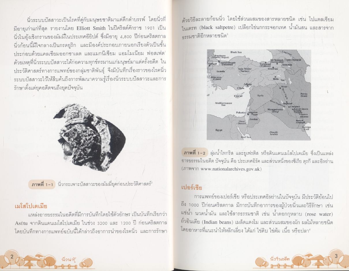 นิ่วน่ารู้