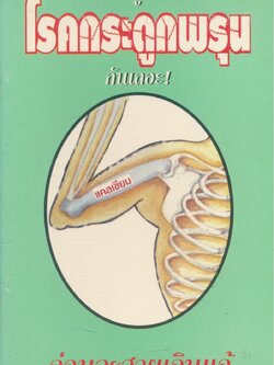 มารู้จัก โรคกระดูกพรุน กันเถอะ! ก่อนจะสายเกินแก้