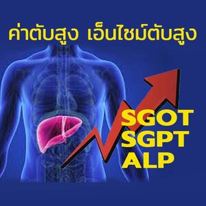 วิธีฟื้นฟู รักษาอาการทันที!! ค่าตับสูง SGOT SGPT ALP สูง ป้องกันก่อนตับอักเสบ