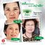 Nano Moisturizer Cream GP4G (ครีมบำรุงป้องกันฝ้า/ลดเลือนริ้วรอย/จุดด่างดำ)