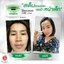 Nano Moisturizer Cream GP4G (ครีมบำรุงป้องกันฝ้า/ลดเลือนริ้วรอย/จุดด่างดำ)