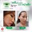 Nano Moisturizer Cream GP4G (ครีมบำรุงป้องกันฝ้า/ลดเลือนริ้วรอย/จุดด่างดำ)