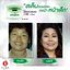 Nano Moisturizer Cream GP4G (ครีมบำรุงป้องกันฝ้า/ลดเลือนริ้วรอย/จุดด่างดำ)