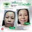 Nano Moisturizer Cream GP4G (ครีมบำรุงป้องกันฝ้า/ลดเลือนริ้วรอย/จุดด่างดำ)