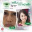 Nano Moisturizer Cream GP4G (ครีมบำรุงป้องกันฝ้า/ลดเลือนริ้วรอย/จุดด่างดำ)