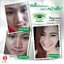 Nano Moisturizer Cream GP4G (ครีมบำรุงป้องกันฝ้า/ลดเลือนริ้วรอย/จุดด่างดำ)