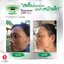 Nano Moisturizer Cream GP4G (ครีมบำรุงป้องกันฝ้า/ลดเลือนริ้วรอย/จุดด่างดำ)